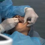 Nerovet AI Dentistry in Action: Case Studies of Enhanced Patient Outcomes in Dentistry Nerovet AI Dentistry